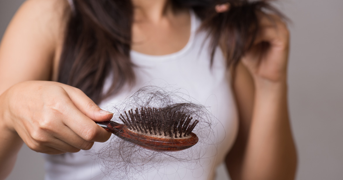 perte de cheveux